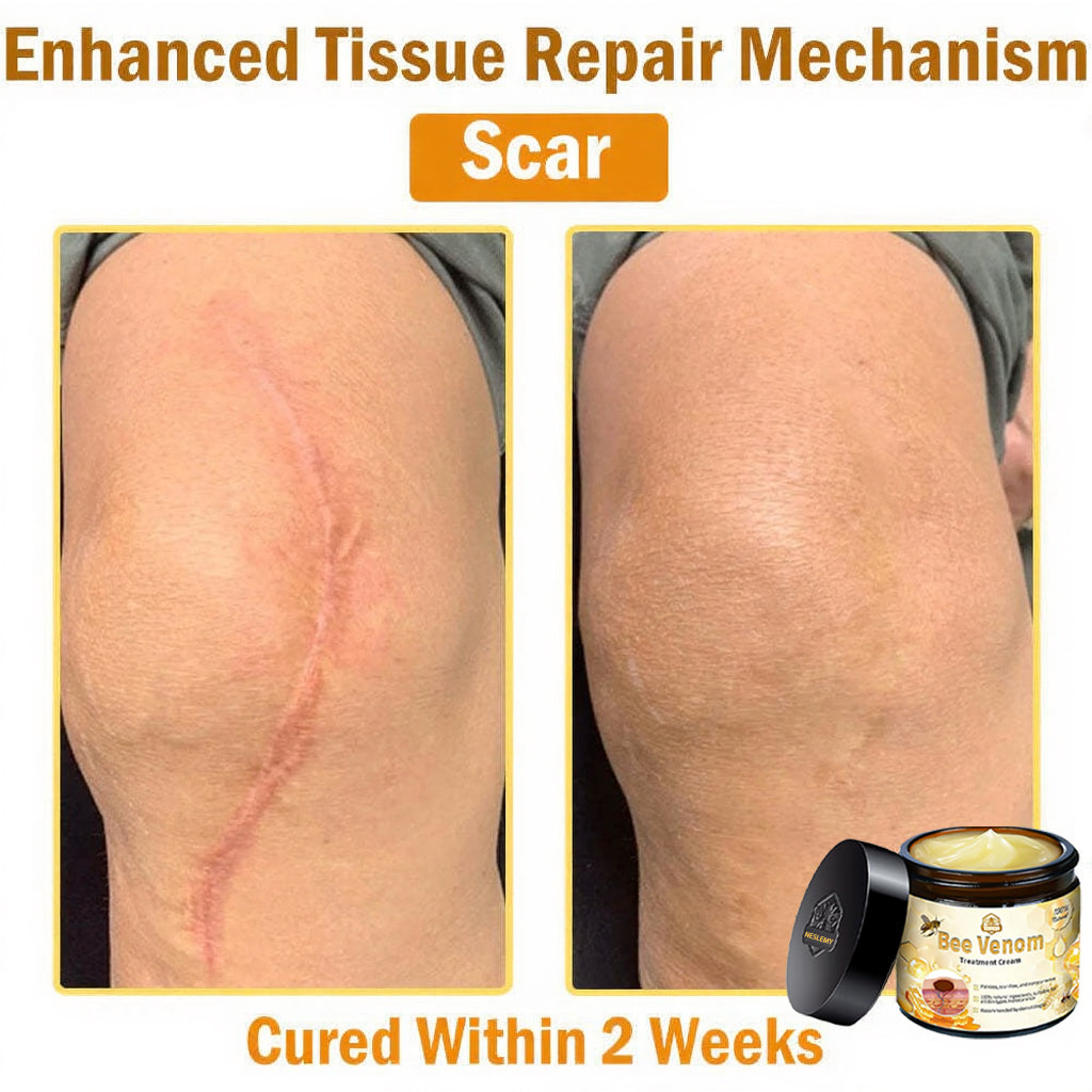 Professional Bee Venom Repair Cream, For All Body Parts