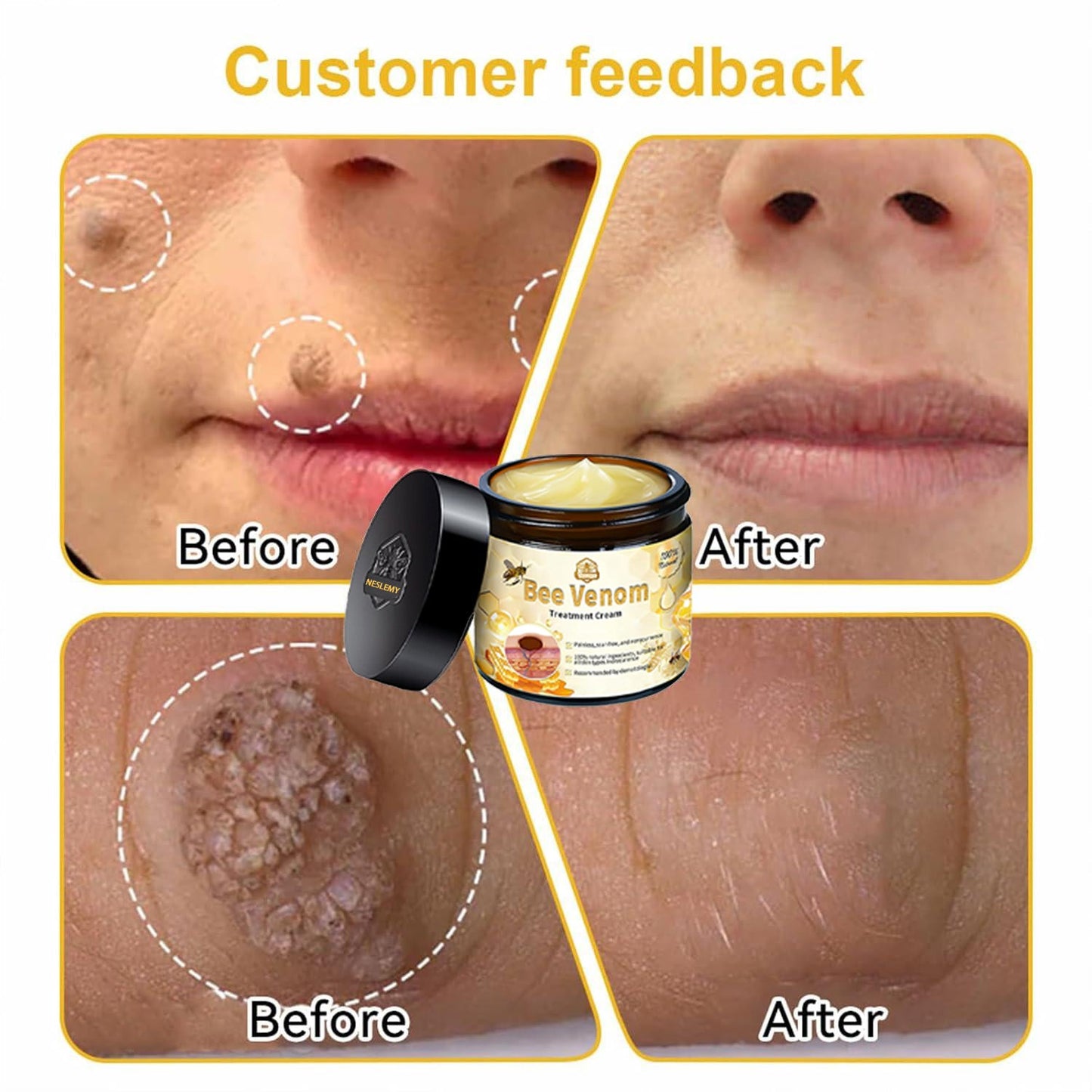 Professional Bee Venom Repair Cream, For All Body Parts