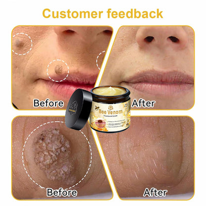 Professional Bee Venom Repair Cream, For All Body Parts