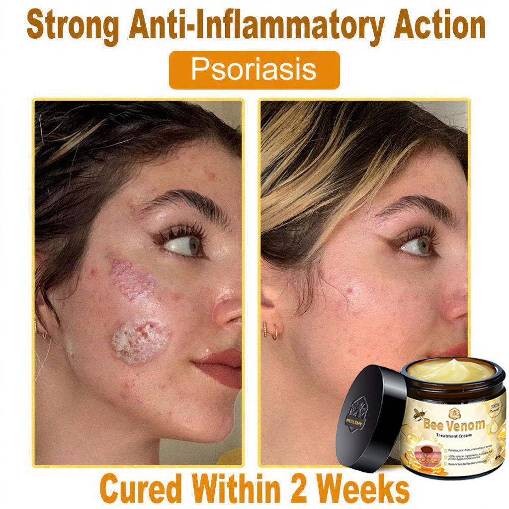 Professional Bee Venom Repair Cream, For All Body Parts